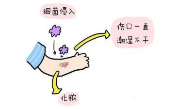 伤口造口专科工作总结5篇